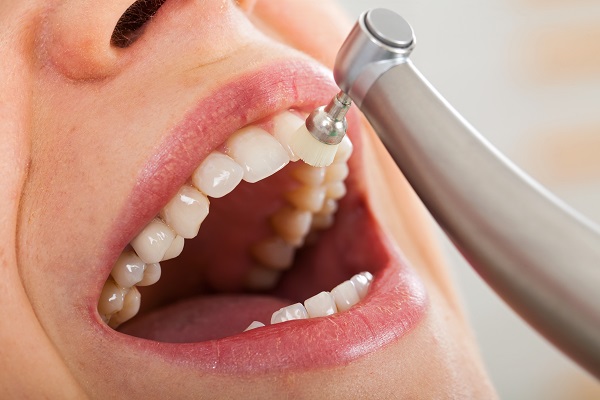 When Should You See A Periodontist For A Dental Deep Cleaning?