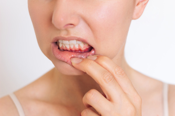 Understanding Gum Recession: Causes And Risk Factors