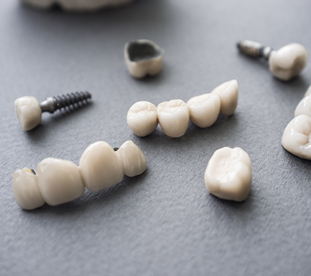 San Diego The Difference Between Dental Implants and Mini Dental Implants