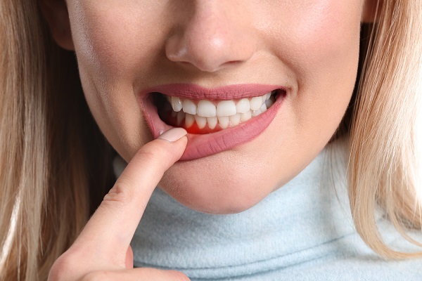 Is Periodontal Disease The Same Thing As A Gum Infection?