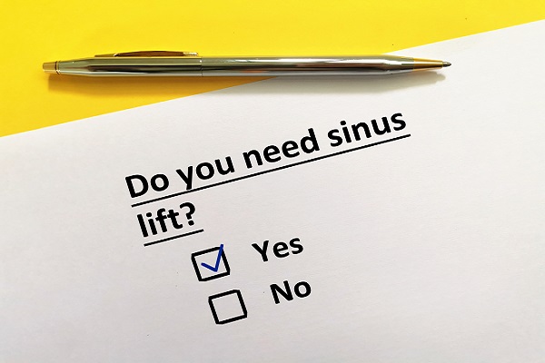 The Importance Of A Sinus Lift Procedure